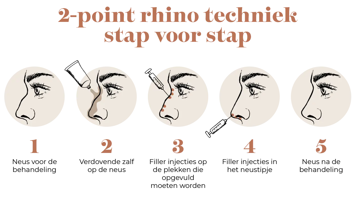 Wat is de 2-point Rhino techniek?