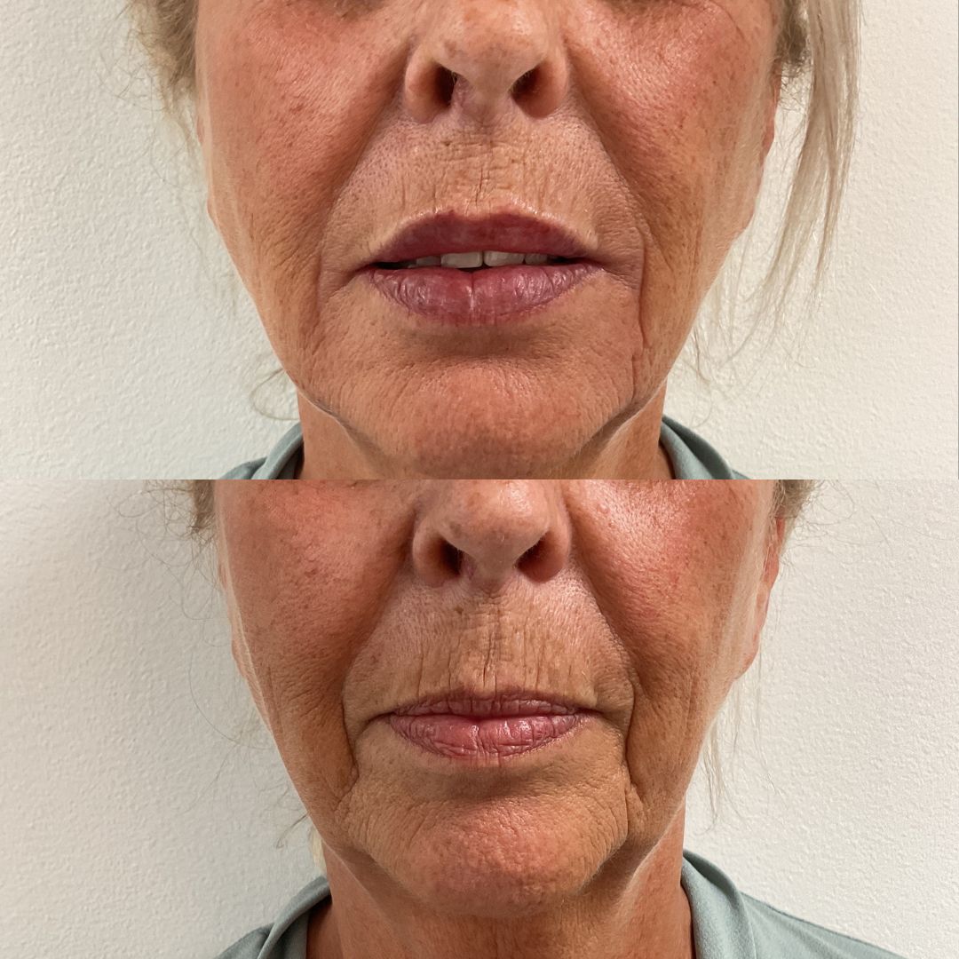 grid-img-{{ loop.index }} 