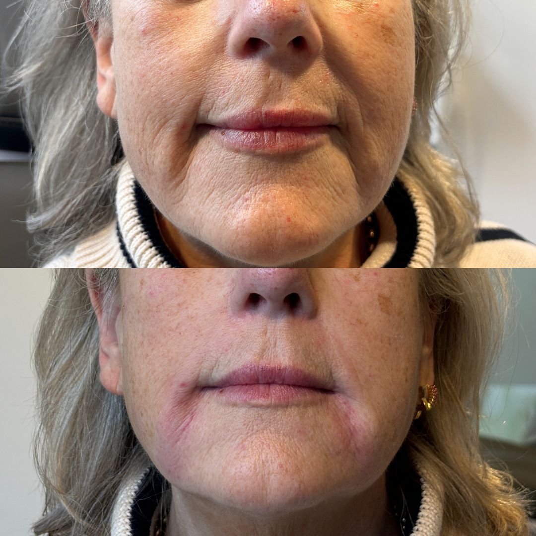 grid-img-{{ loop.index }} 