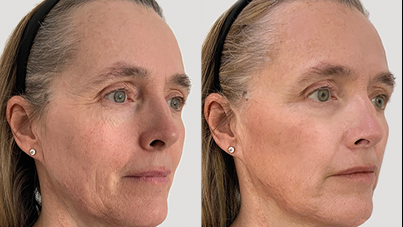 grid-img-{{ loop.index }} 