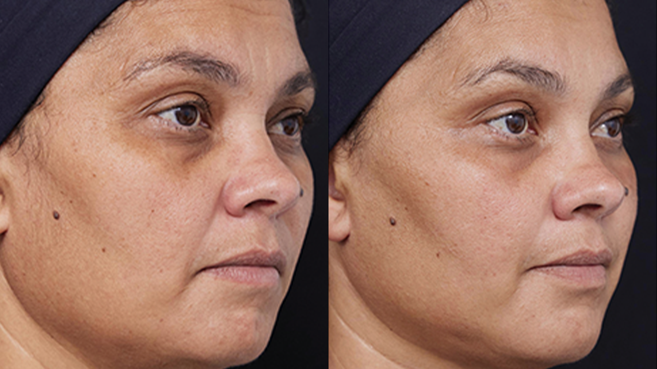 grid-img-{{ loop.index }} 