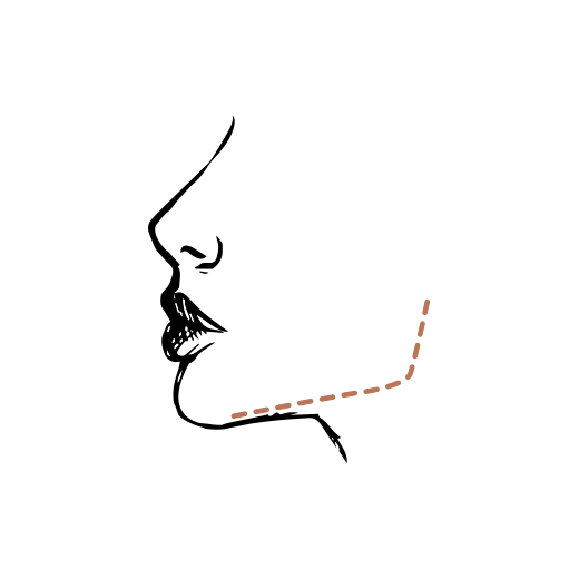 Hyalase